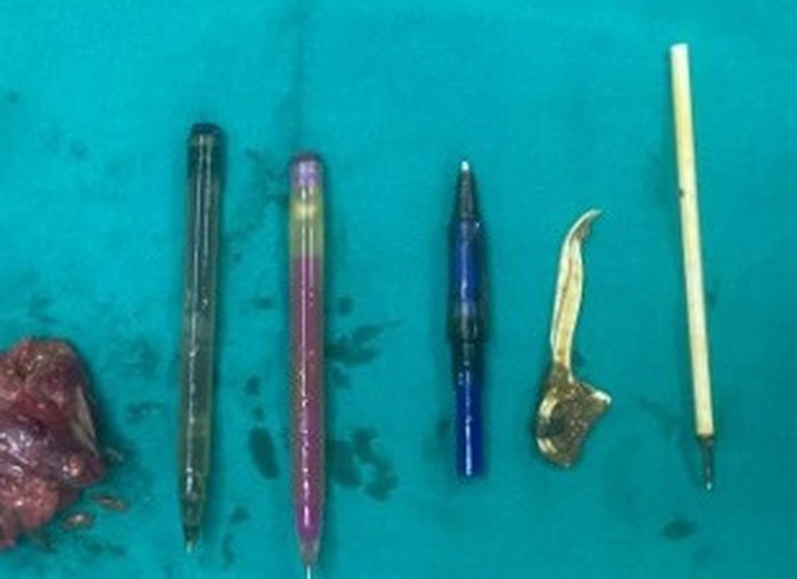 di-vat-va-benh-pham-1737466373640492029375 Bệnh gì khiến một người thích ăn các đồ vật không phải thức ăn? - Ảnh 1.